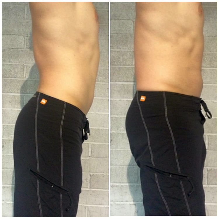 lordosis-lower-back-pain-help, lumbar-support-belt -
